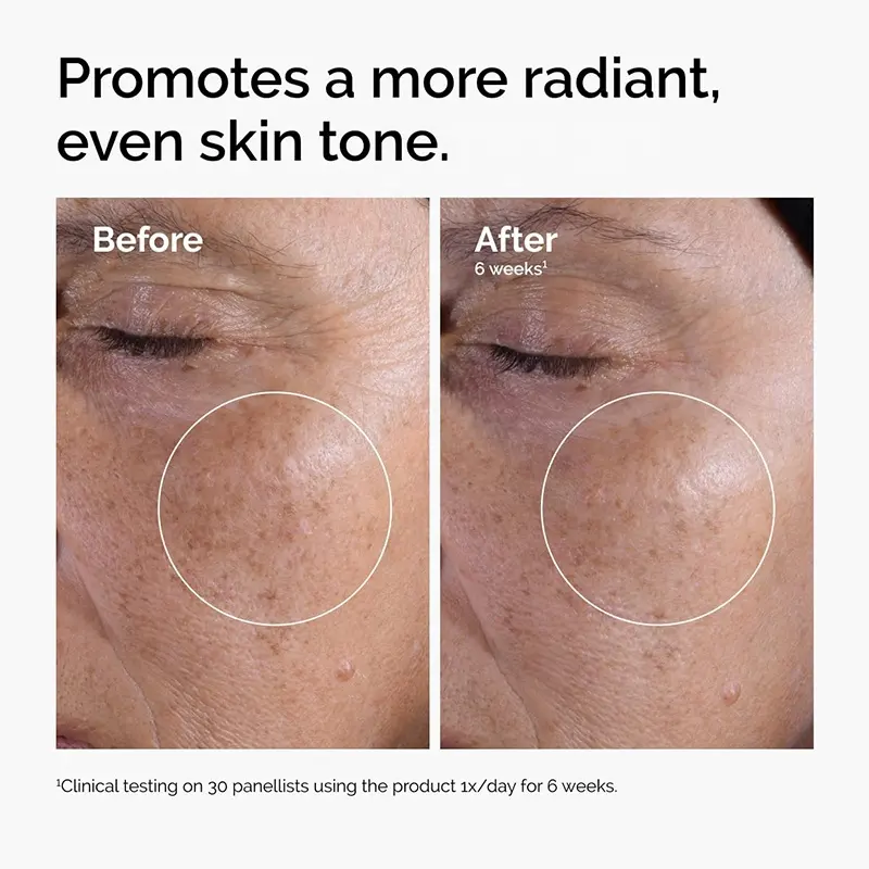 Customized 7% Glycolic Acid Toner to Improve Closed Comedones, Tighten Pores Spray and Moisturizer