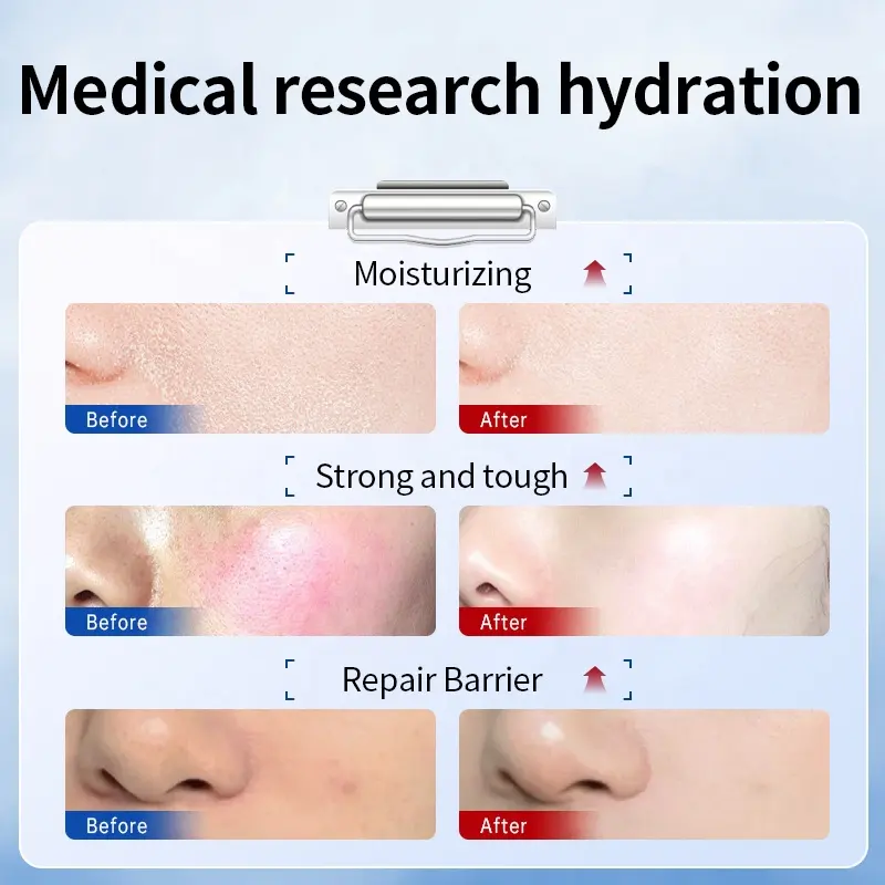 OEM/ODM Custom Skincare Hydrating Toner, Lotion, Face Cream with Plant-Based Formula and Moisturizing Effect