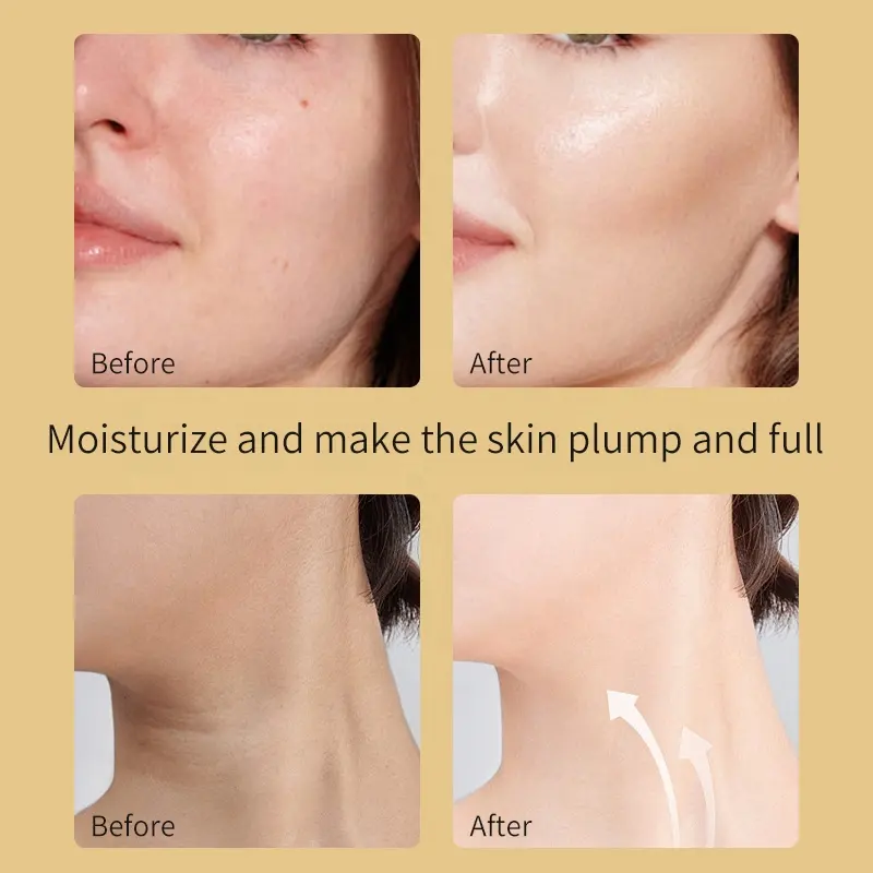 AESTHTANY 150g Bee Venom Face & Neck Cream Quickly Absorb Softening Firming Refreshing Revitalizing Daily Facial Neck Skin Care