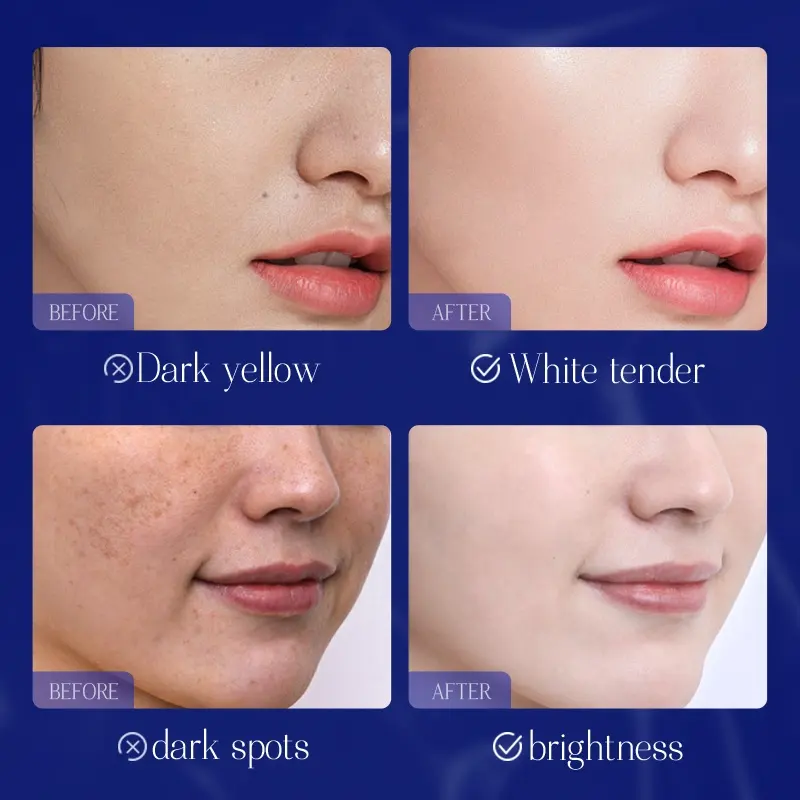 OEM Bisutang 377 Niacinamide Cream 50g Moisturizing Glowing Even Skin Tone Hydrating Brightening for All Skin Types Facial Care