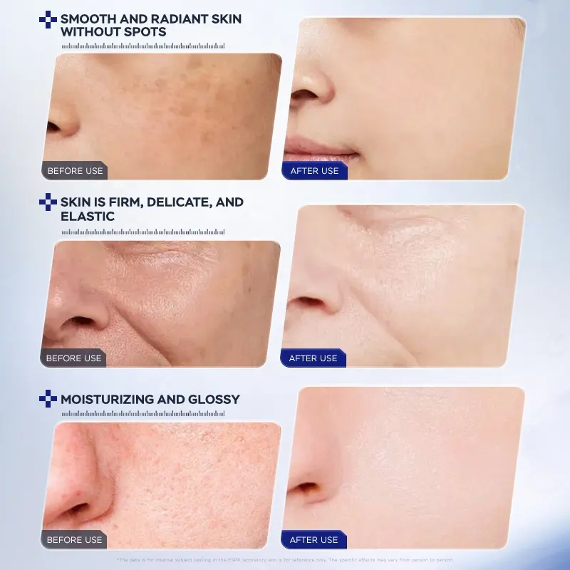 ESCP Vitamin C Face Serum Deep Hydrating Smooth Fine Lines Skin Firming Gentle Daily Facial Care Suitable for All Skin Types