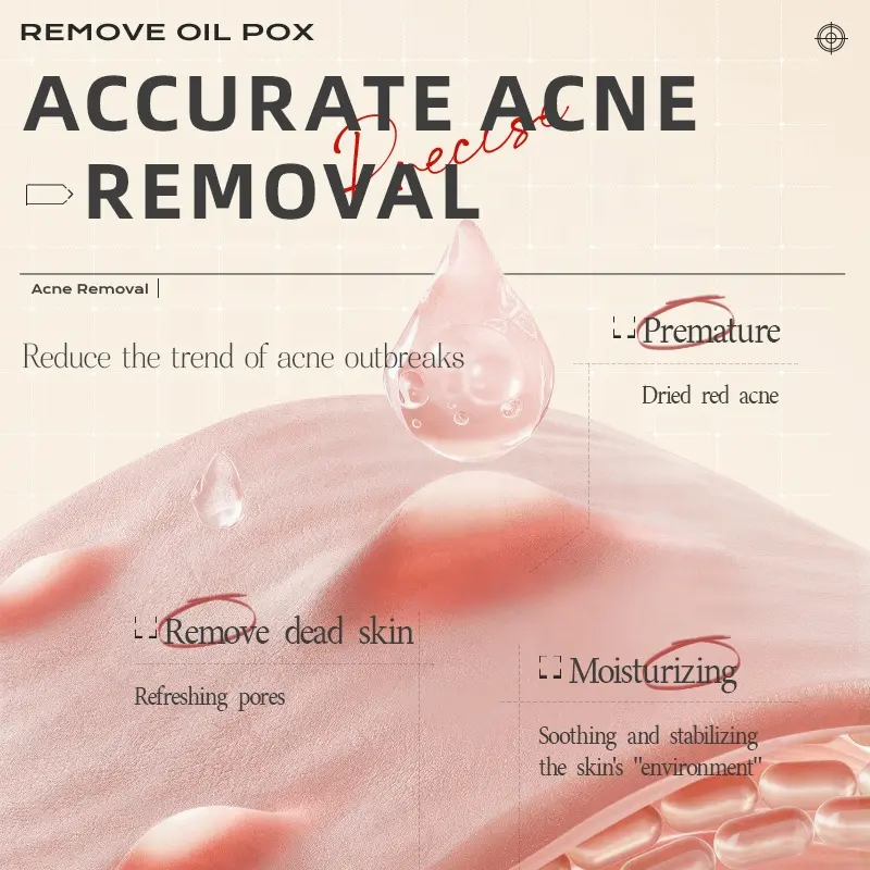 OEM Double Acid Acne Serum Soothes Repairs Lightens Acne Marks Brightens Skin Tone Hydrates Moisturizes Essence