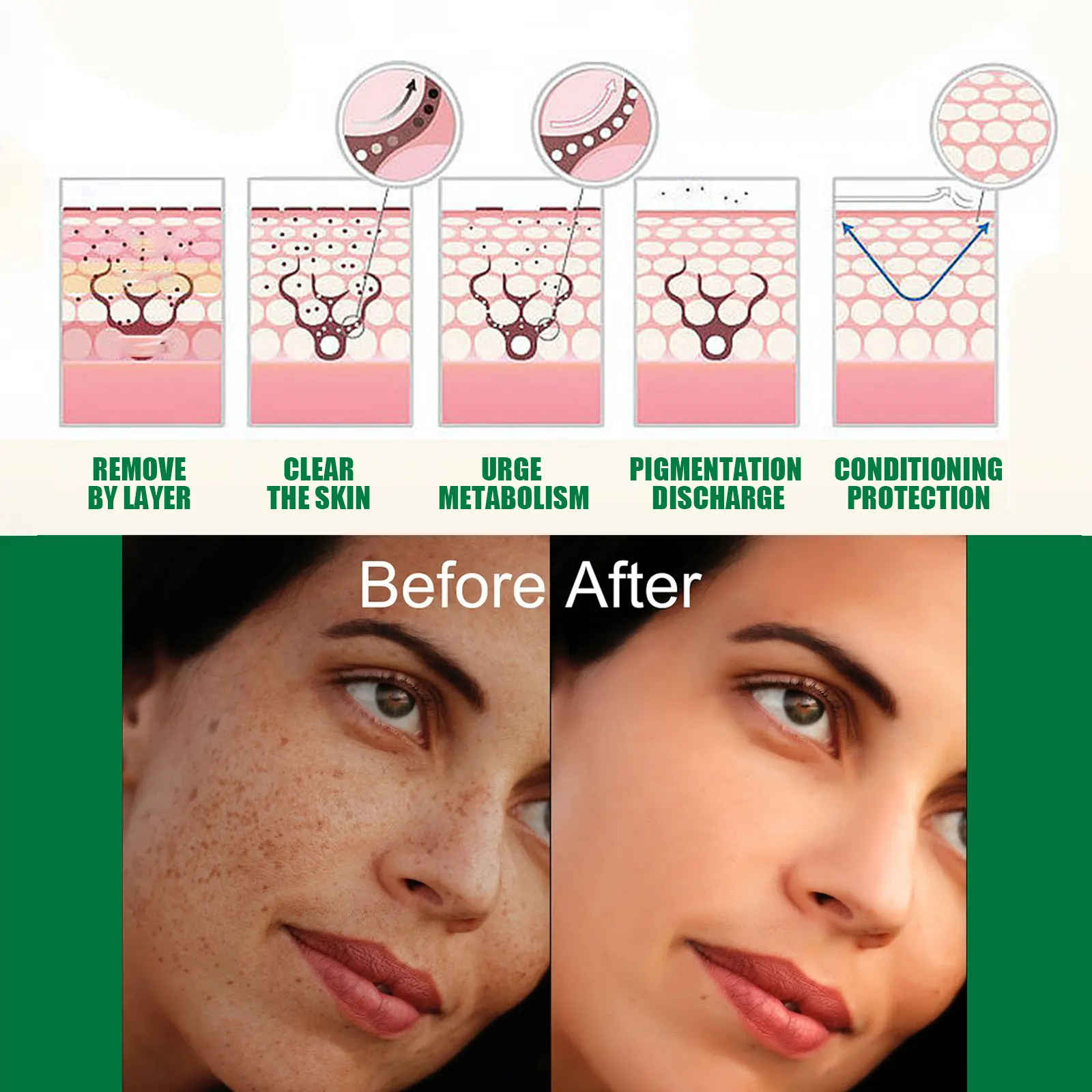 OEM Private Label Skin Care Products Acne Remover Essence Dark Spot Remover Serum Face Skin Care Anti-acne Facial Cream