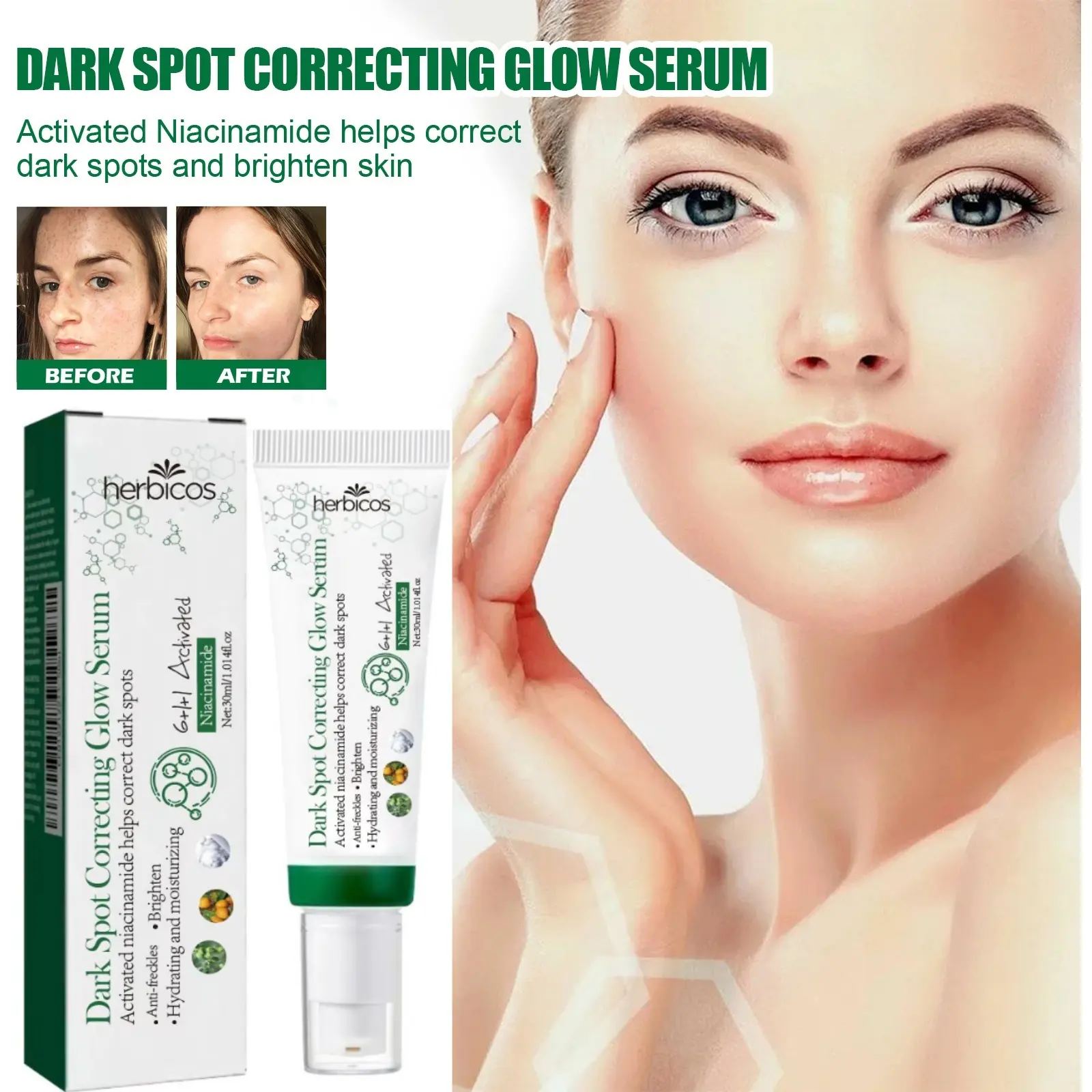 OEM Private Label Skin Care Products Acne Remover Essence Dark Spot Remover Serum Face Skin Care Anti-acne Facial Cream