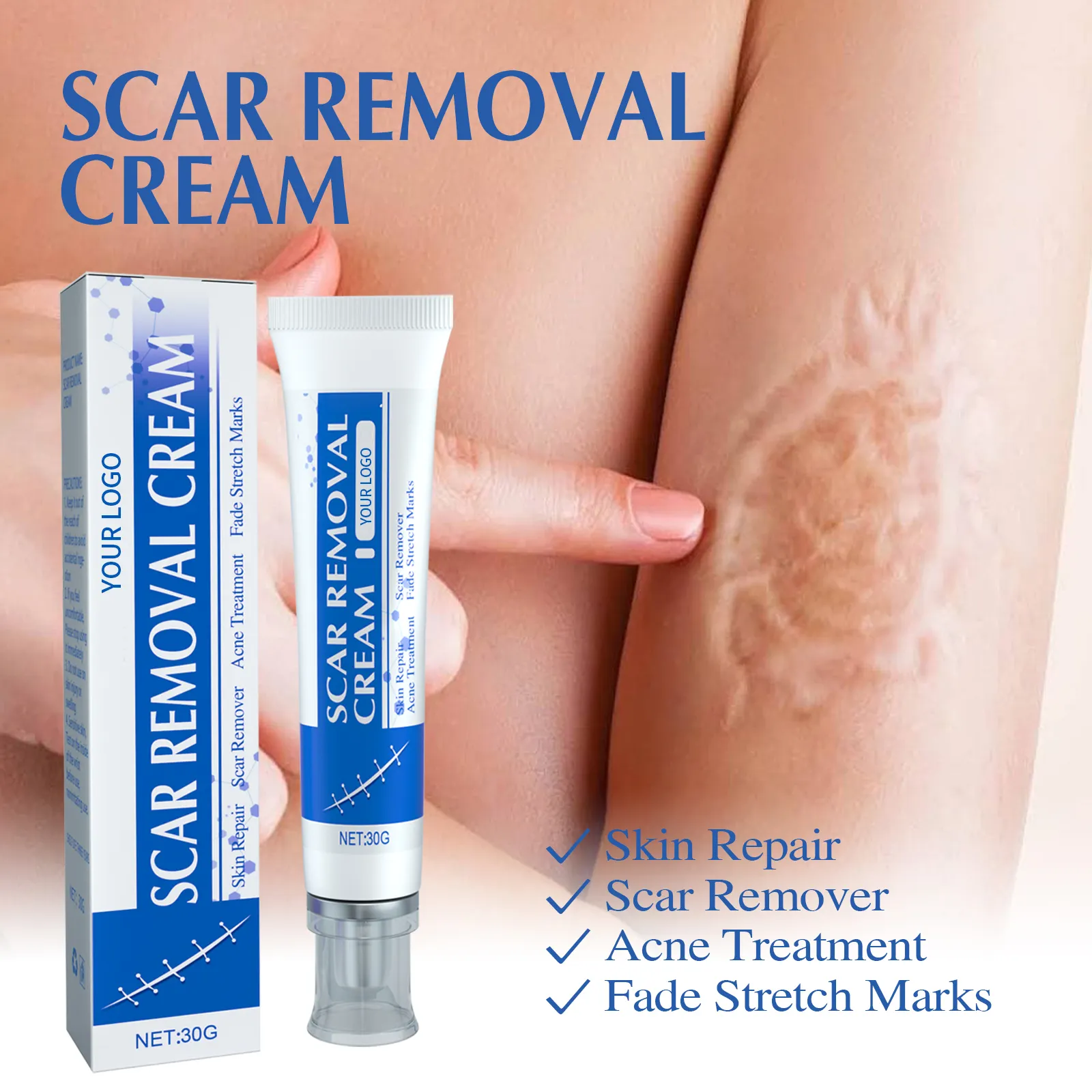 Customized logo Private Label Fastest Scar Removal Gel Bruises Repair Reduce Stretch Marks Scar Repair Cream Oem