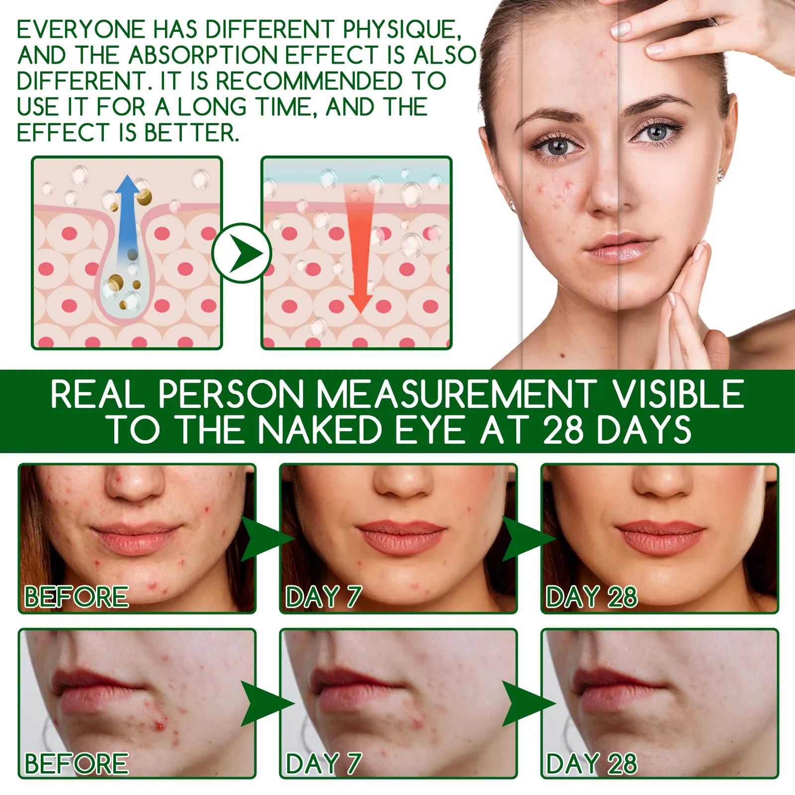 Wholesale Double Effect Acne Removing Serum Private Label Organic Oil Control Exfoliating Repair Acne Repair Face Serum