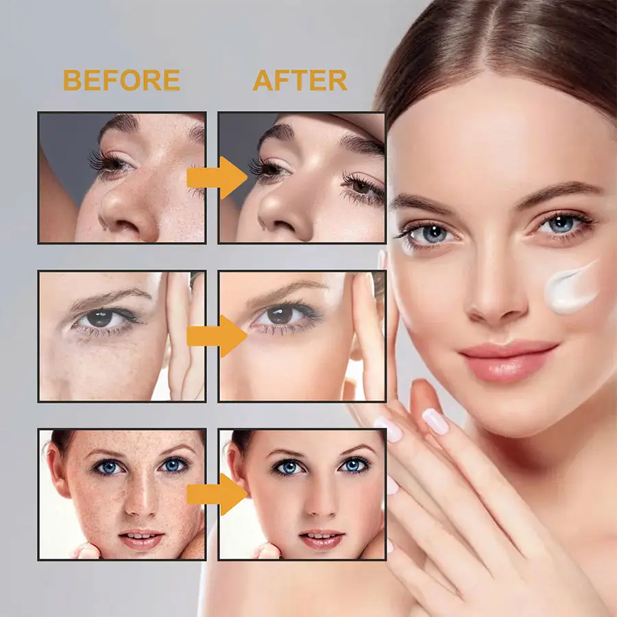 Private Label Cream for Dark Spot Remover Facial Care with Lycyrrhiza Glabra Phenethylresorcinol 377