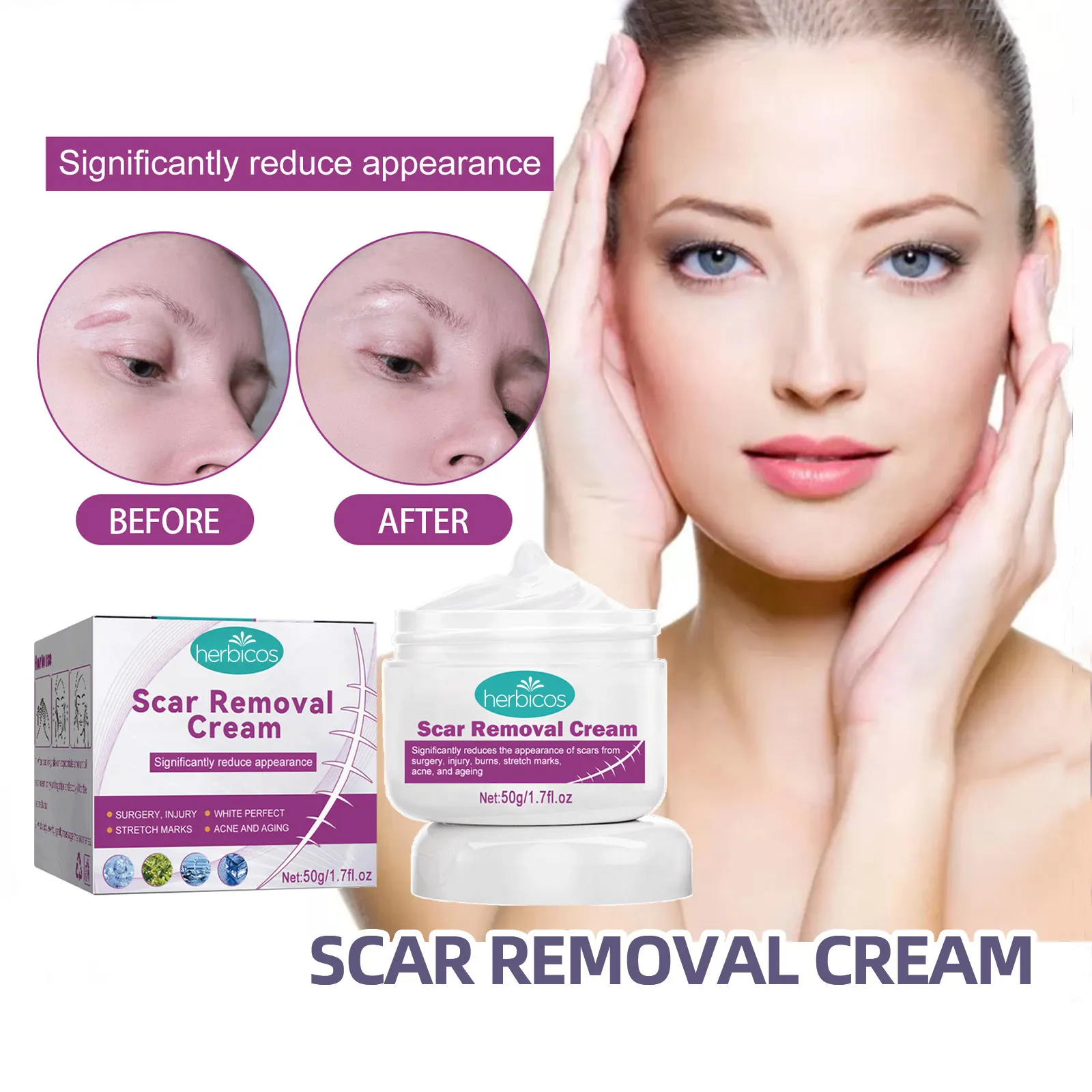 Herbicos Acne Scar Removal Creamstretch Marks Repairing Cream Body Lotion Pregnant Pregnancy Women Day Adults Hyaluronic Acid