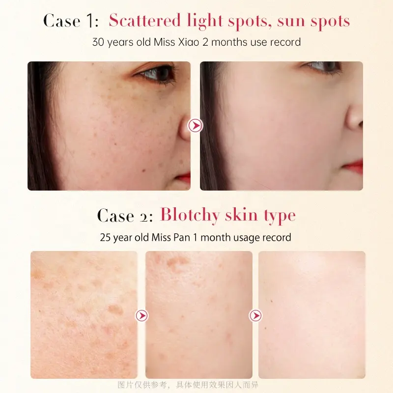 OEM Niacinamide Arbutin Whitening Blemish Face Mask Jumbo/Family Pack Hydrating Moisturizing Blemish Reducing Facial Care Skin