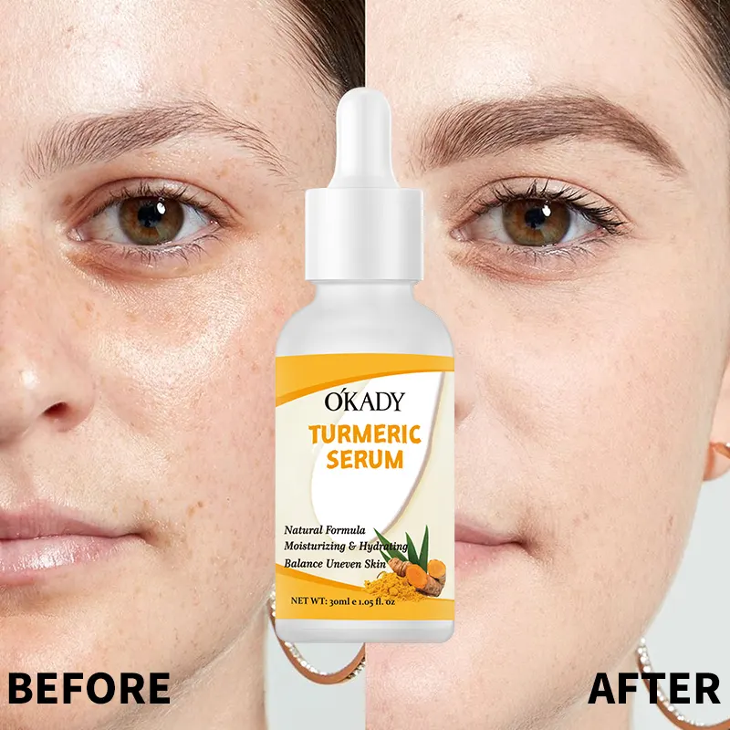 O'KADY 30ml Turmeric Facial Serum with Vegan Niacinamide for Brightening Anti-Aging & Balancing Uneven Skin Tone Daily Care OEM