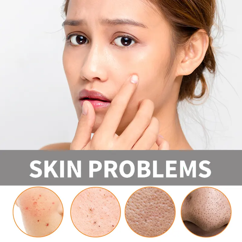 OEM ODM Deep Cleaning Carbon Mud Facial Mask Stick for Sensitive Skin Beauty Whitening Products