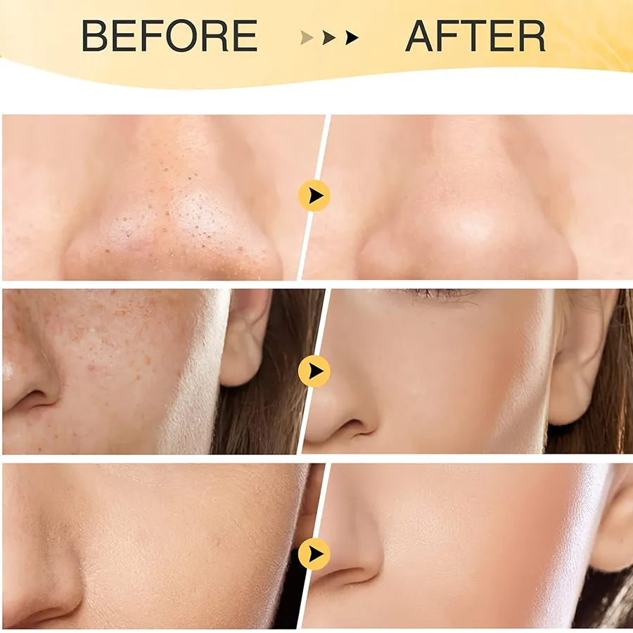 For Herbicos Private Label Whitening Moisturizing Turmeric Mud Mask ODM/OEM Facial Repair Skincare Product for Face & Body Use