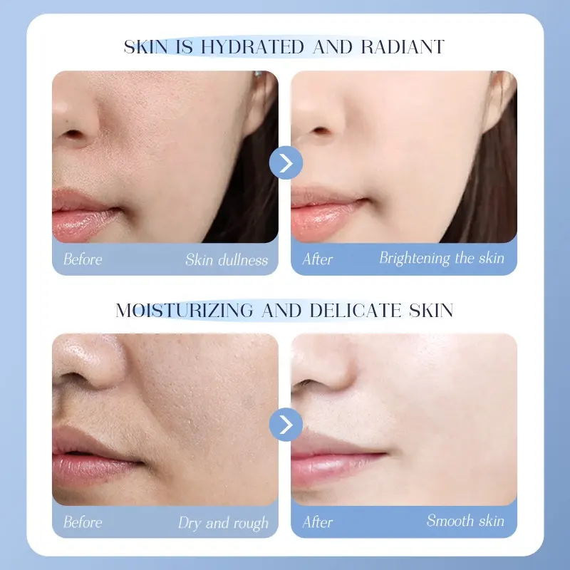 Nicotinamide Brightening Sheet Mask Rose Water Centella Asiatica Extract Targets Dullness Improves Skin Tone Turkic Rose Oil