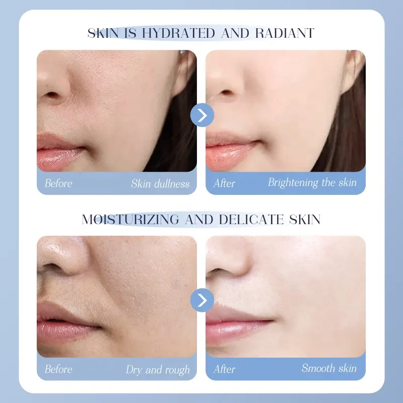 OEM Avocado Nourishing Face Mask Sheet Marigold Colden Chamomile Camellia Sodium Hyaluronate Dry Skin Relief Smoothness