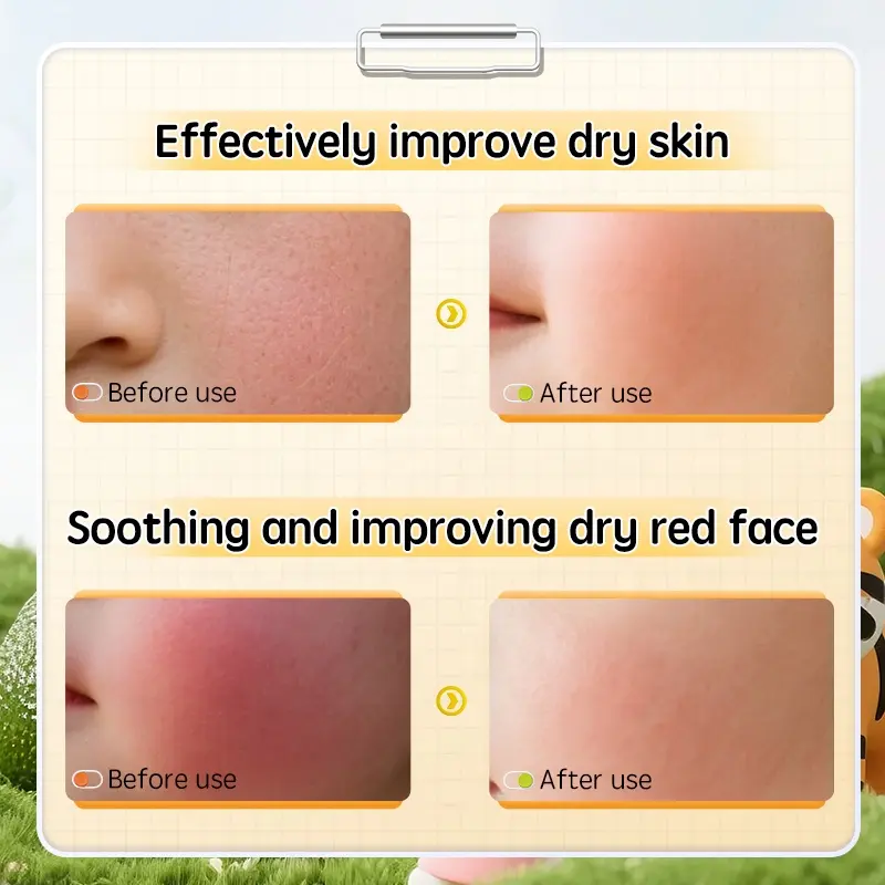 BISUTANG Children's Moisturizing Face Mask with Cute Animal Print, 20ml X 5pcs, Gentle Tencel Material