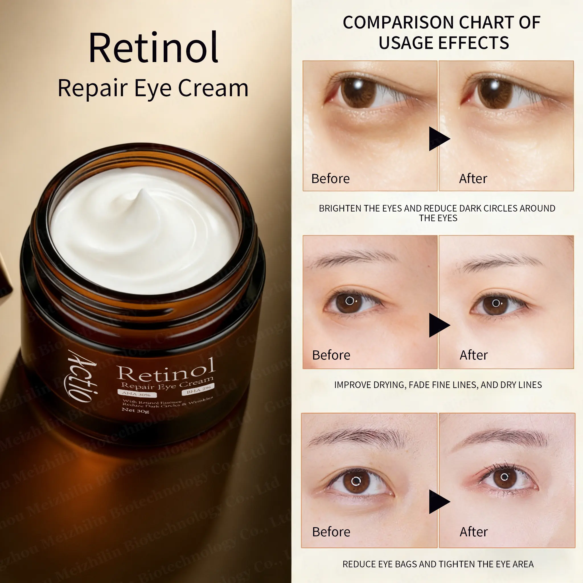 Private Label Dark Circle Wrinkle Reducing Eye Cream Set for Fine Lines and Brightening for Dryness Eye