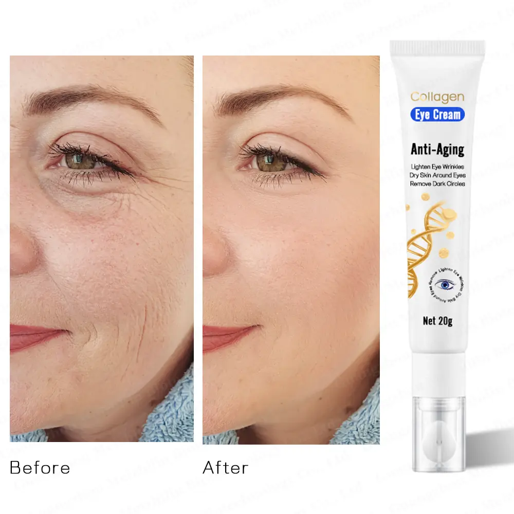 Private Label Collagen Eye Cream Repair Wrinkles & Dark Circles Deep Moisture Bright & Firm Eyes for Dry Eye Skin
