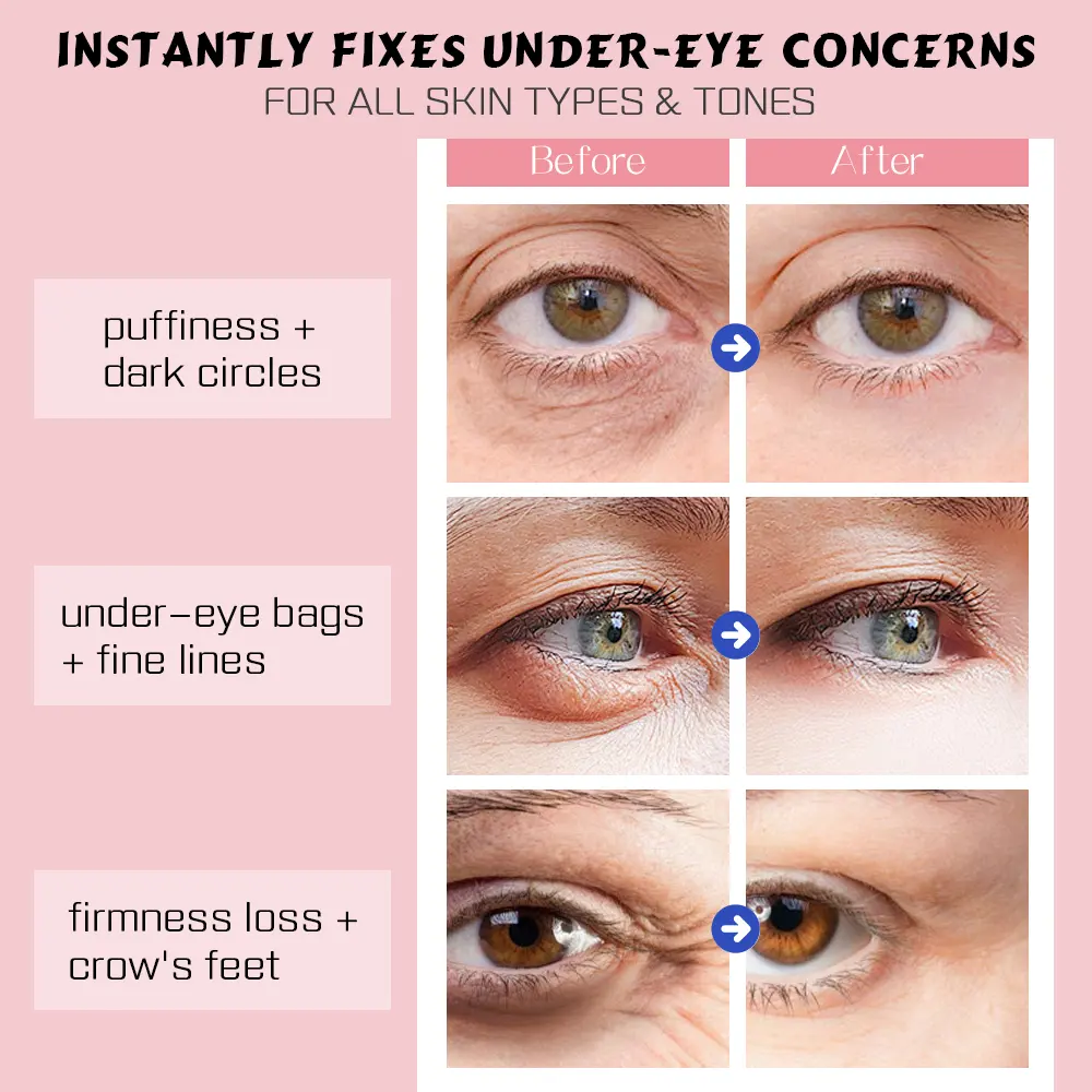 Oem Odm Snail Repair Eye Cream Lifting With Massage Device Moisture & Smooth Eye Skin Reduce Fine Lines