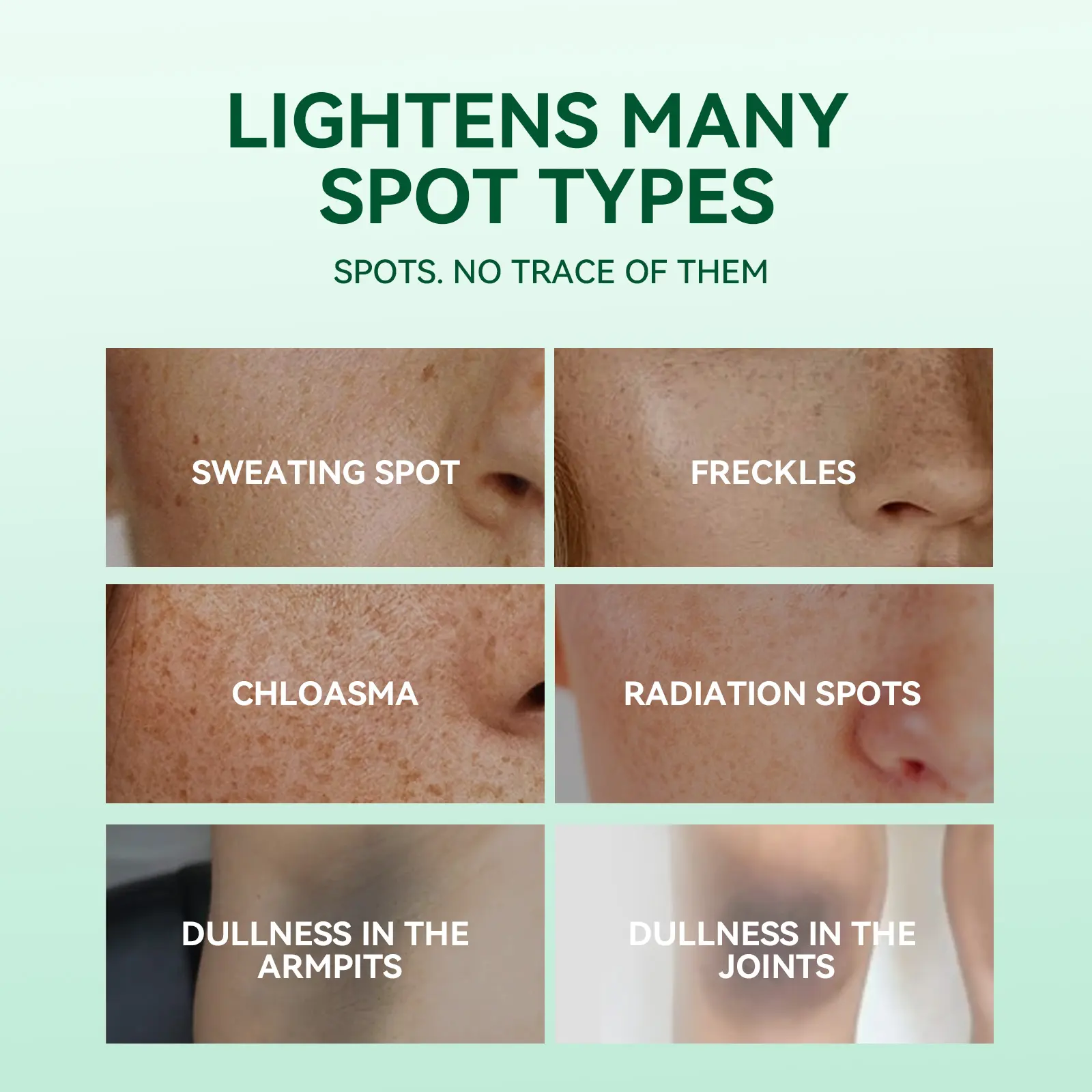 Private Label Dark Spot Face Serum Hyperpigmentation Vitamin C Niacinamide Brightening Essence Wholesale Skin Care Products OEM