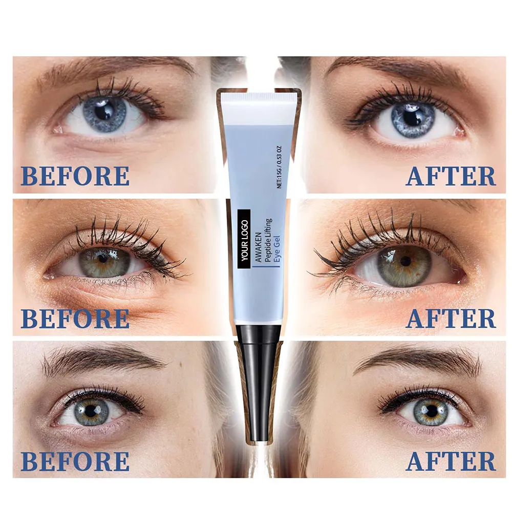 Herbicos Anti-Wrinkle Lightening Fine Lines Dark Circles Around the Eyes Firming Hydrating Moisturizing Firming Eye Gel