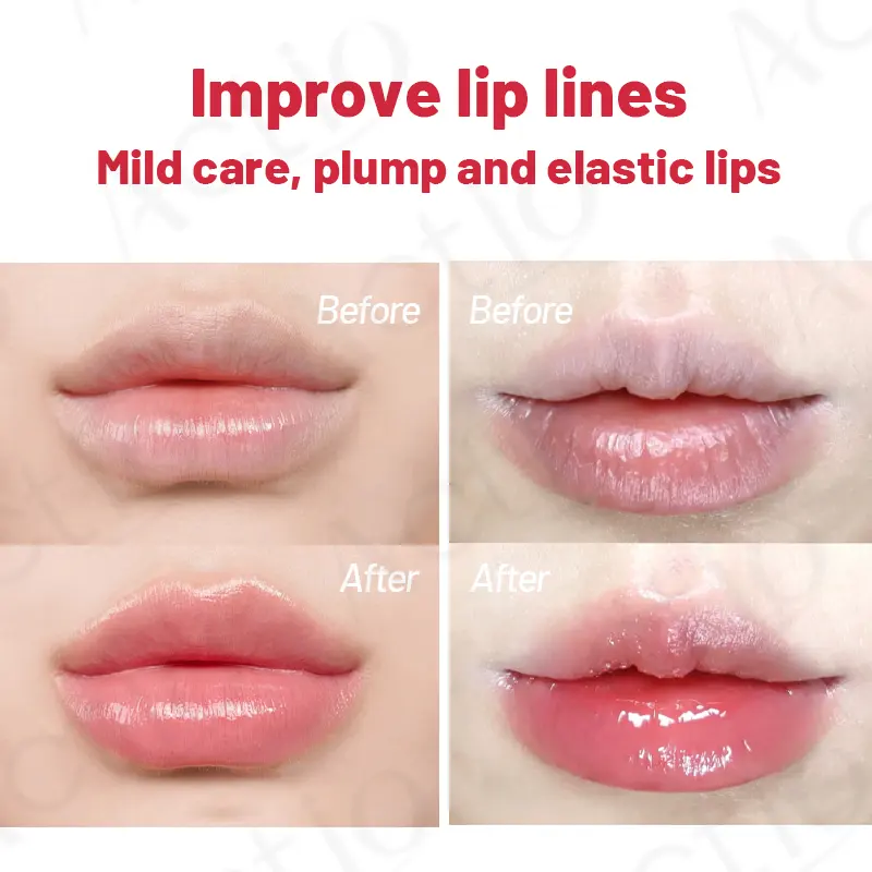 Hyaluronic Collagen Lip Mask Oem Soothing Lip Patch for Lip Care Hydrating Moisturizing Nourishing Exfoliating