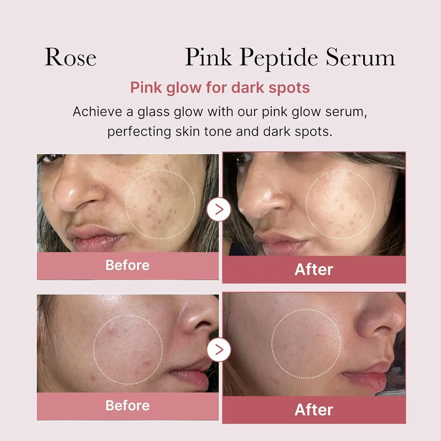Vegan Rose-Highlighting Facial Serum 30ml ODM Glow Wrinkle & Firming Skin Care Product Targeting Eye & Hand with Free Sample
