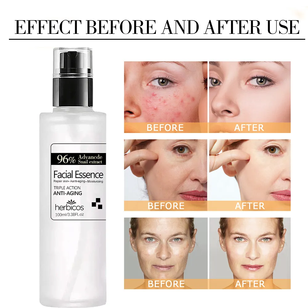 Private Label 96% for Extract Mucin Power for Essence Oil Moisturizing Korea Skin Care Snail Serum for Face