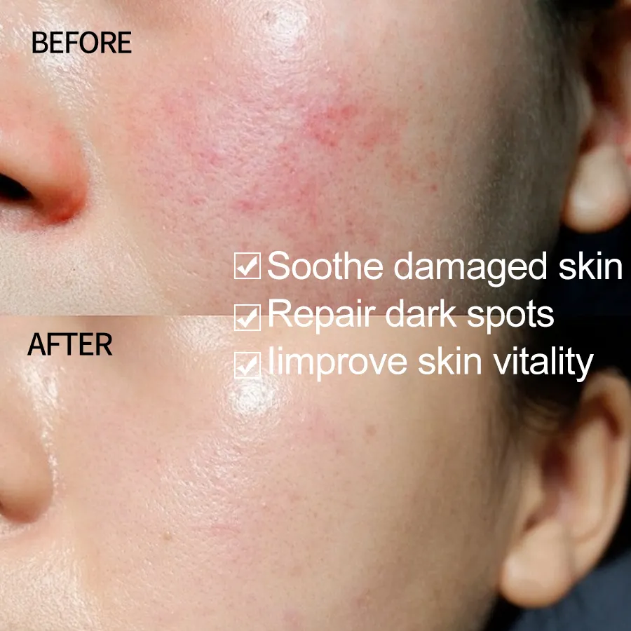 Private Label 96% for Extract Mucin Power for Essence Oil Moisturizing Korea Skin Care Snail Serum for Face