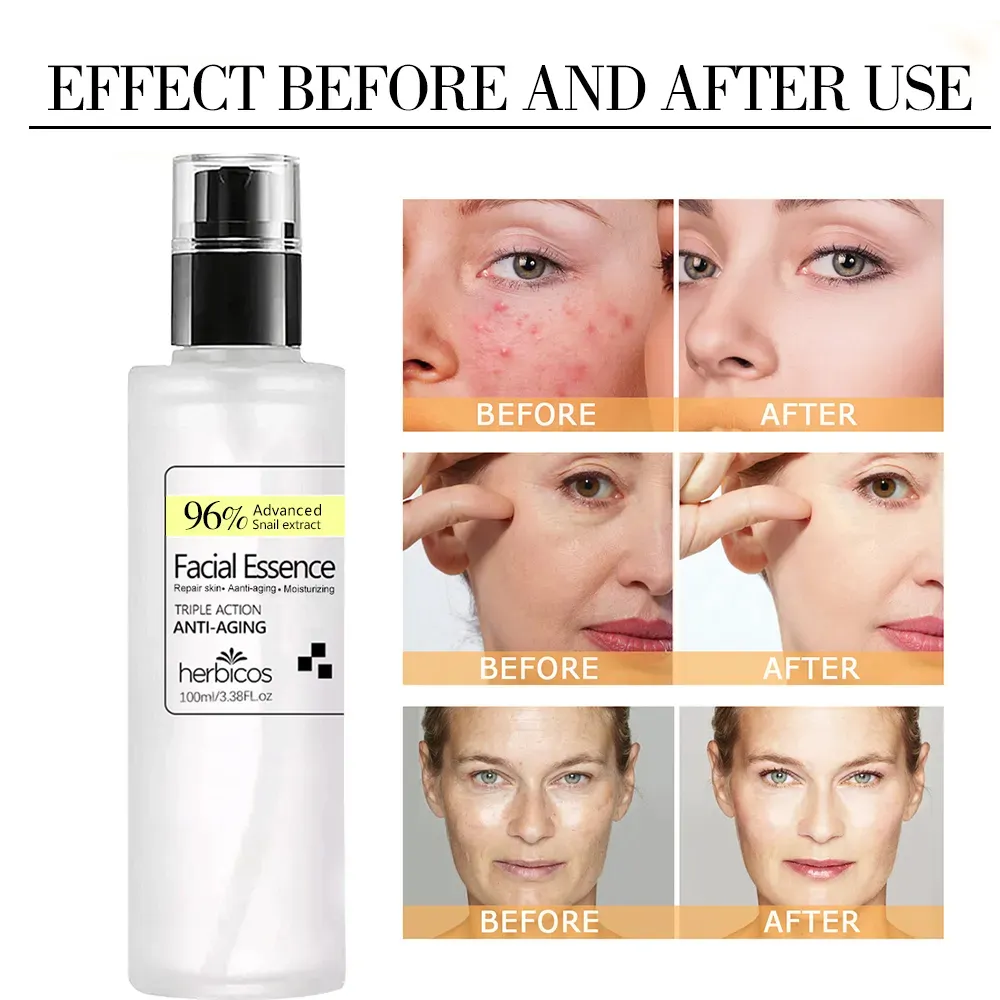 Private Label Skin Care Products Korean Cosmetics Moisturizing Whitening Serum 96 Mucin Power Essence Snail Serum