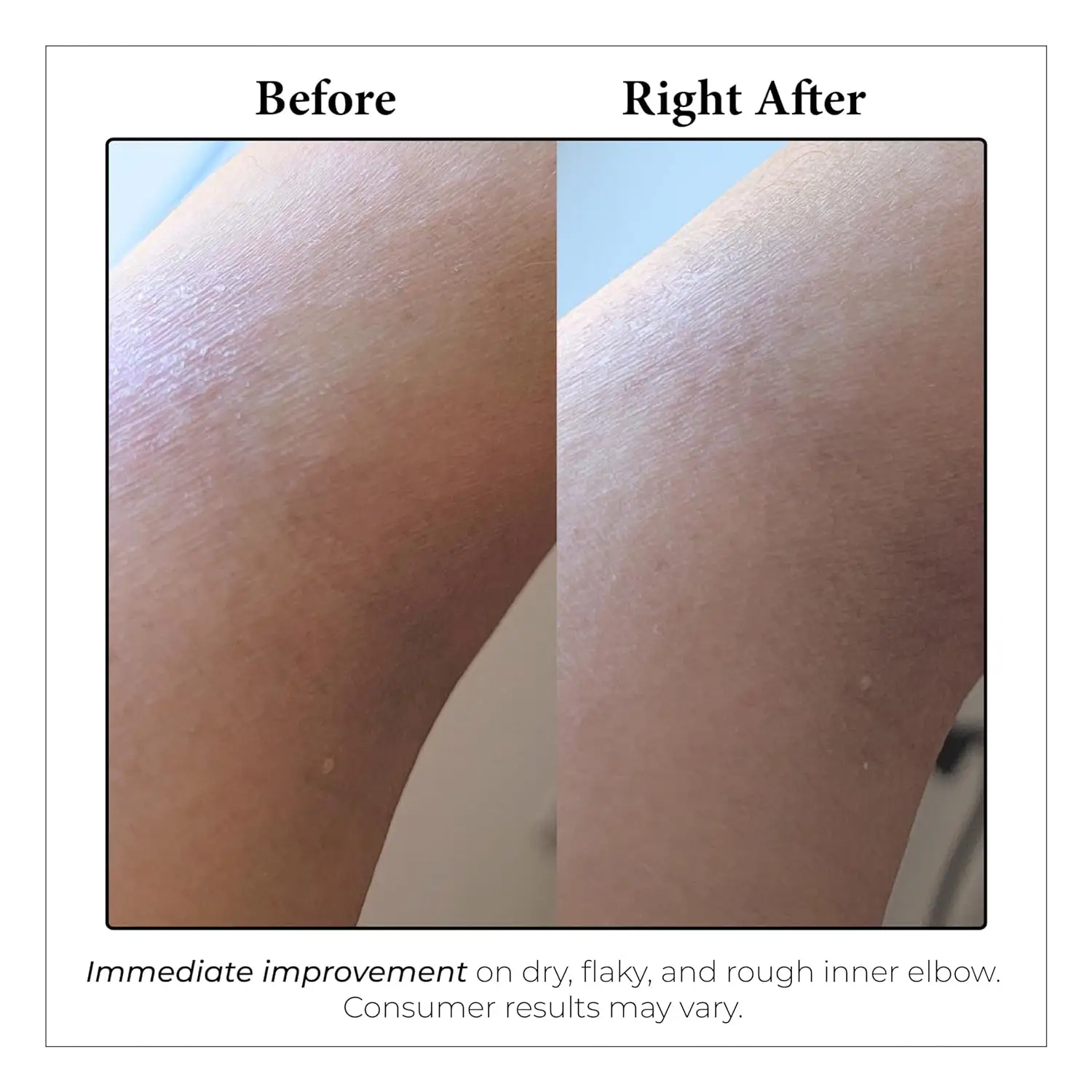 Eucalyptus Spearmint Aromatherapy Body Cream, Ultimate Hydration Moisturizer for Stress Eucalyptus Mint Deep Hydrate Body Lotion