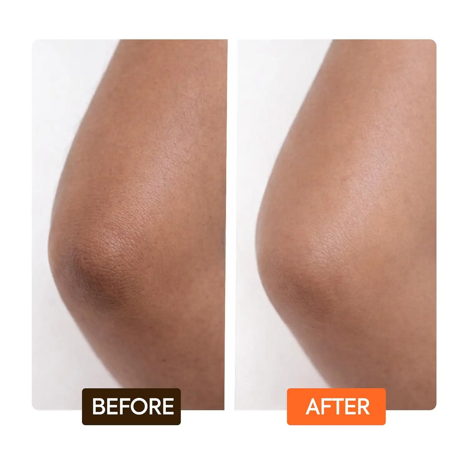 Carotene Body Lotion Fights Excess Oil Production | Helps Fade Body Scars and Marks Carrot Honey Body Lotion