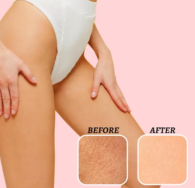 Premium Facial Body Scrub 250g Shea Sugar Scrub with Tea Tree Exfoliating Body Scrub for Smooth Skin Easy to Rinse