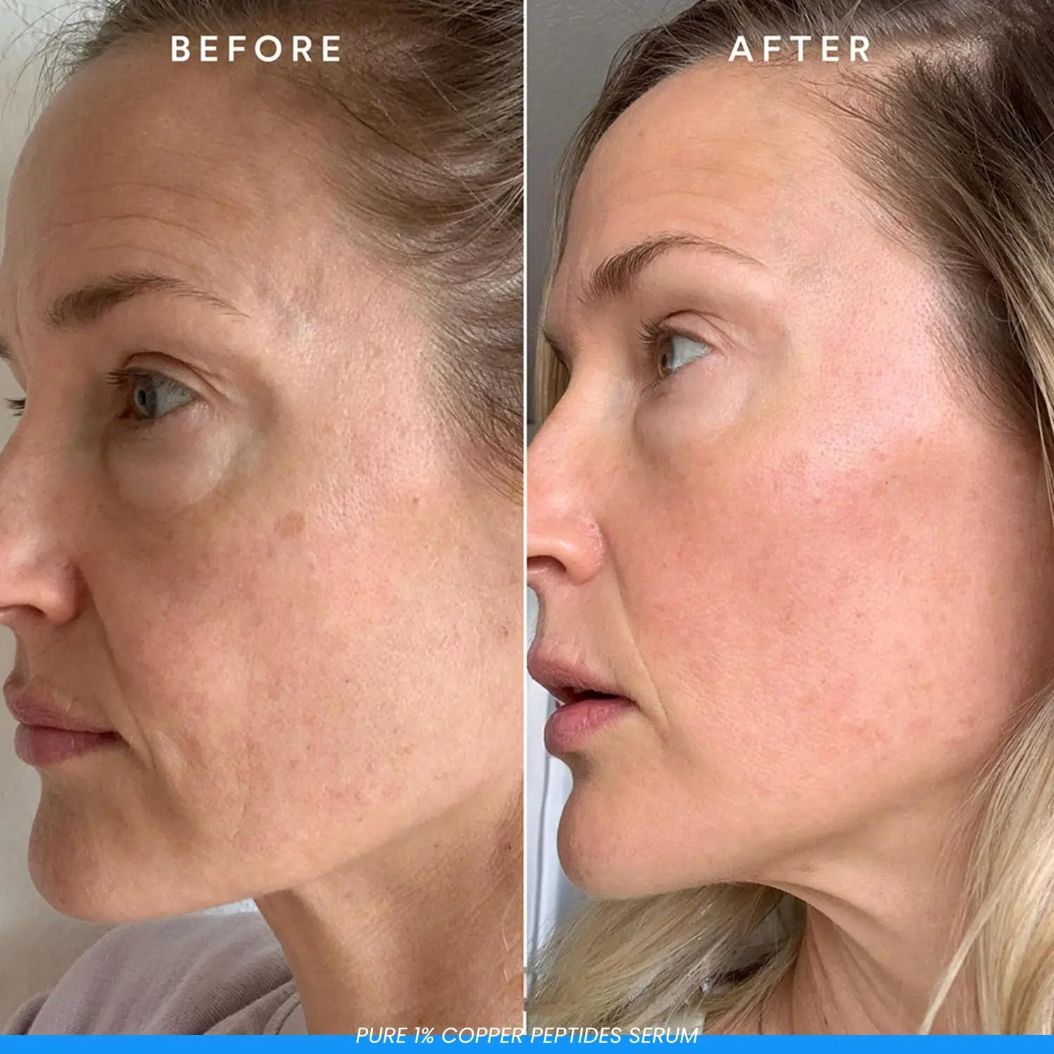 GHK-cu Face Serum Super Peptide Serum Anti-Aging Facial Oil with Copper Tripeptides for Plumping and Firming with Witch Hazel