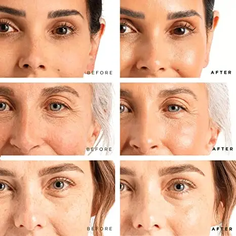 3 in 1 BIO STEM CELL , FILLER, DNA SERUM , ANTI WRINKLE , FIRMING , 100% NATURAL EXTRACTS Anti Wrinkle Whitening Serum