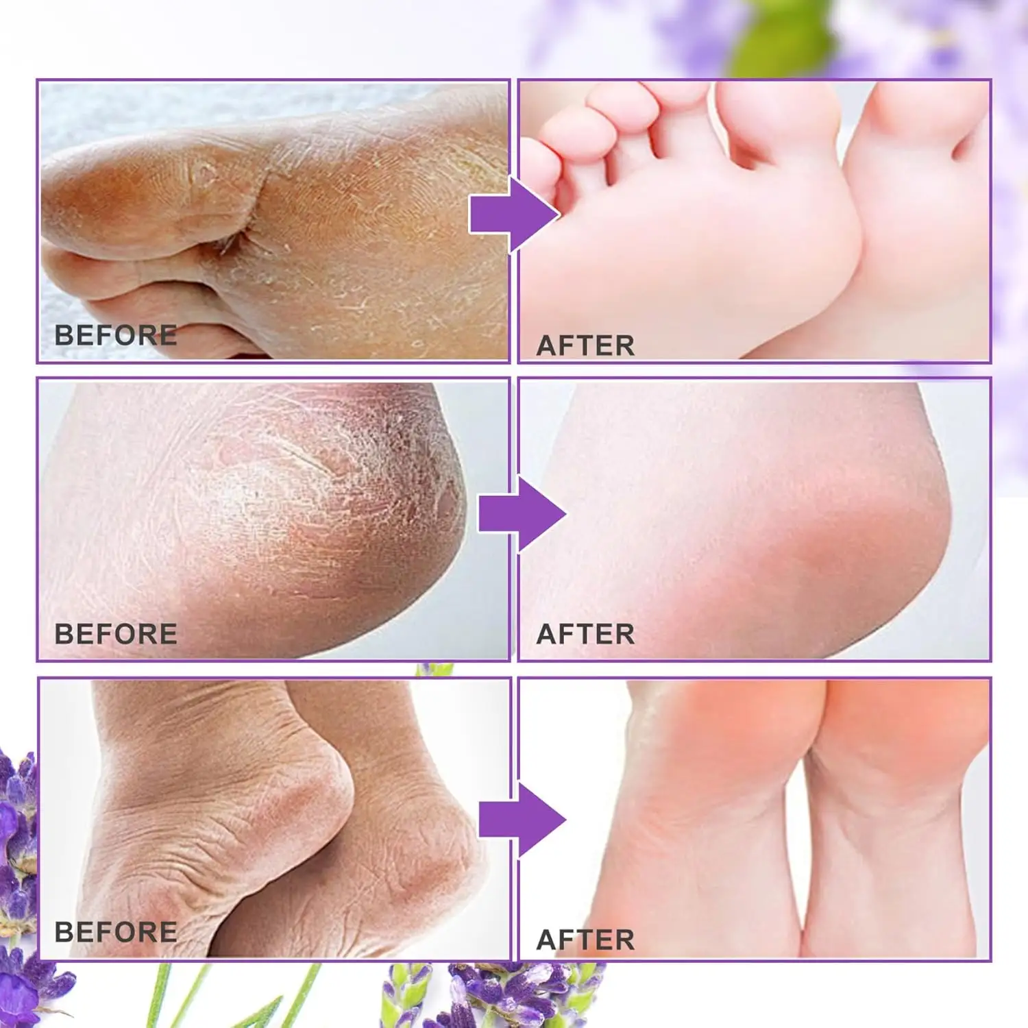 Foot Peel Mask 3 Pack, Exfoliator Peel Off Calluses Dead Skin Callus Remover, Baby Soft Smooth Touch Feet-Men Women