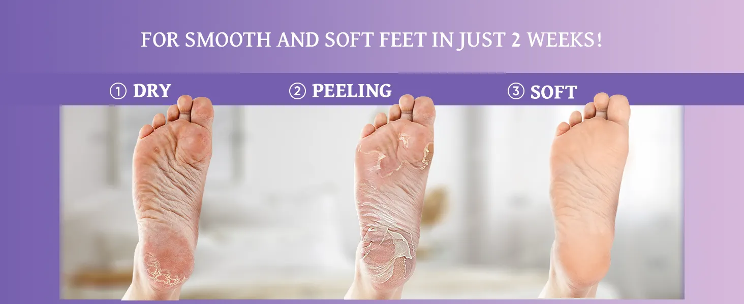 Herbal Foot Peeling Mask (3-pack) Exfoliating Peel off Calluses Dry Skin Cracked Heels for Smooth Moist Baby Skin for Adults