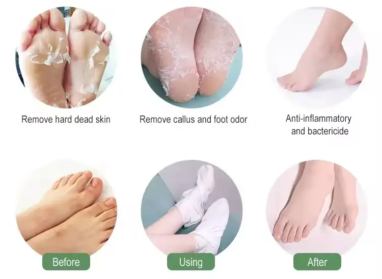 Private Label Pedicure Treatment Feet Peeler Spa Foot Mask Beauty Peeling Exfoliating Callus Remover Skin Care Foot Mask