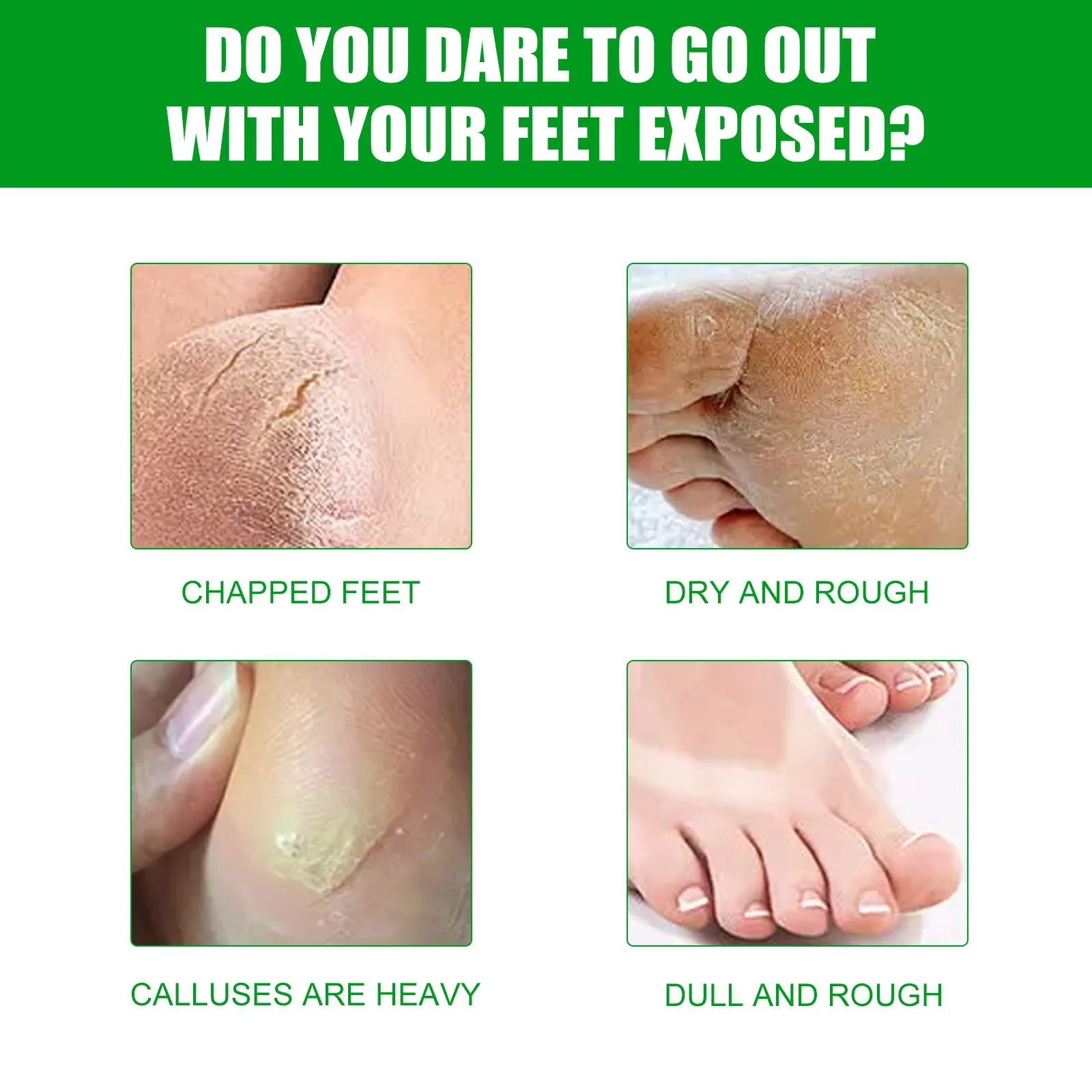 Custom logo Natural Skin Care Aloe Vera Exfoliating Foot Mask Whitening Deep Hydration Moisturizing Remove Cocoons Foot Mask