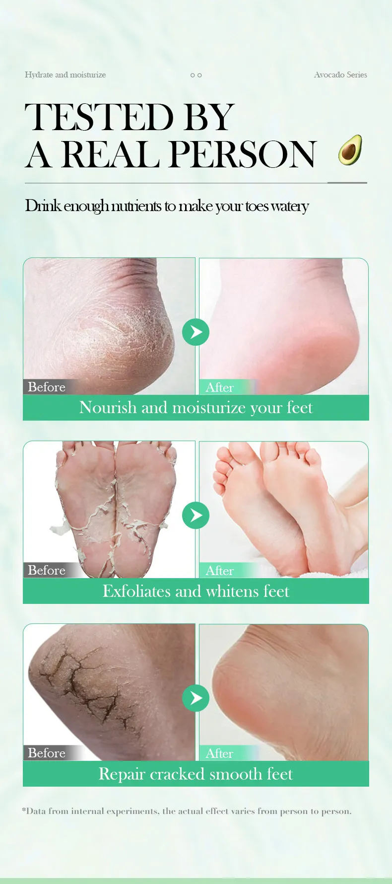 Private Label OEM Intensive Moisturizing Socks Feet Avocado Extract VE Foot Peeling Mask Dry Relief Exfoliating Foot Mask