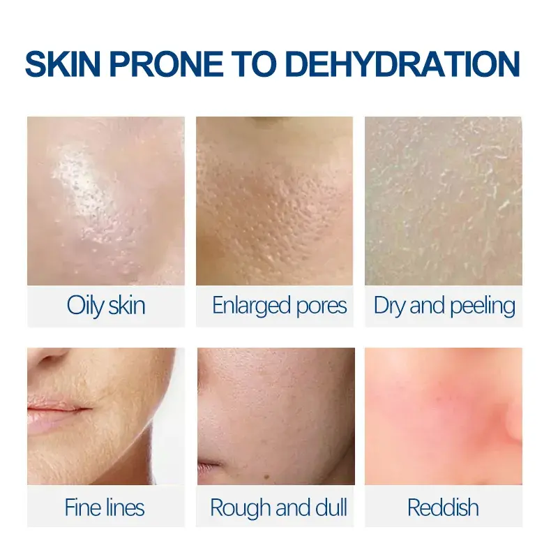 Private Brand Soothing Sensitive Skin Toner Whitening Moisturizing Spray Oil Control Shrinking Pores Skin CareYeast Essence