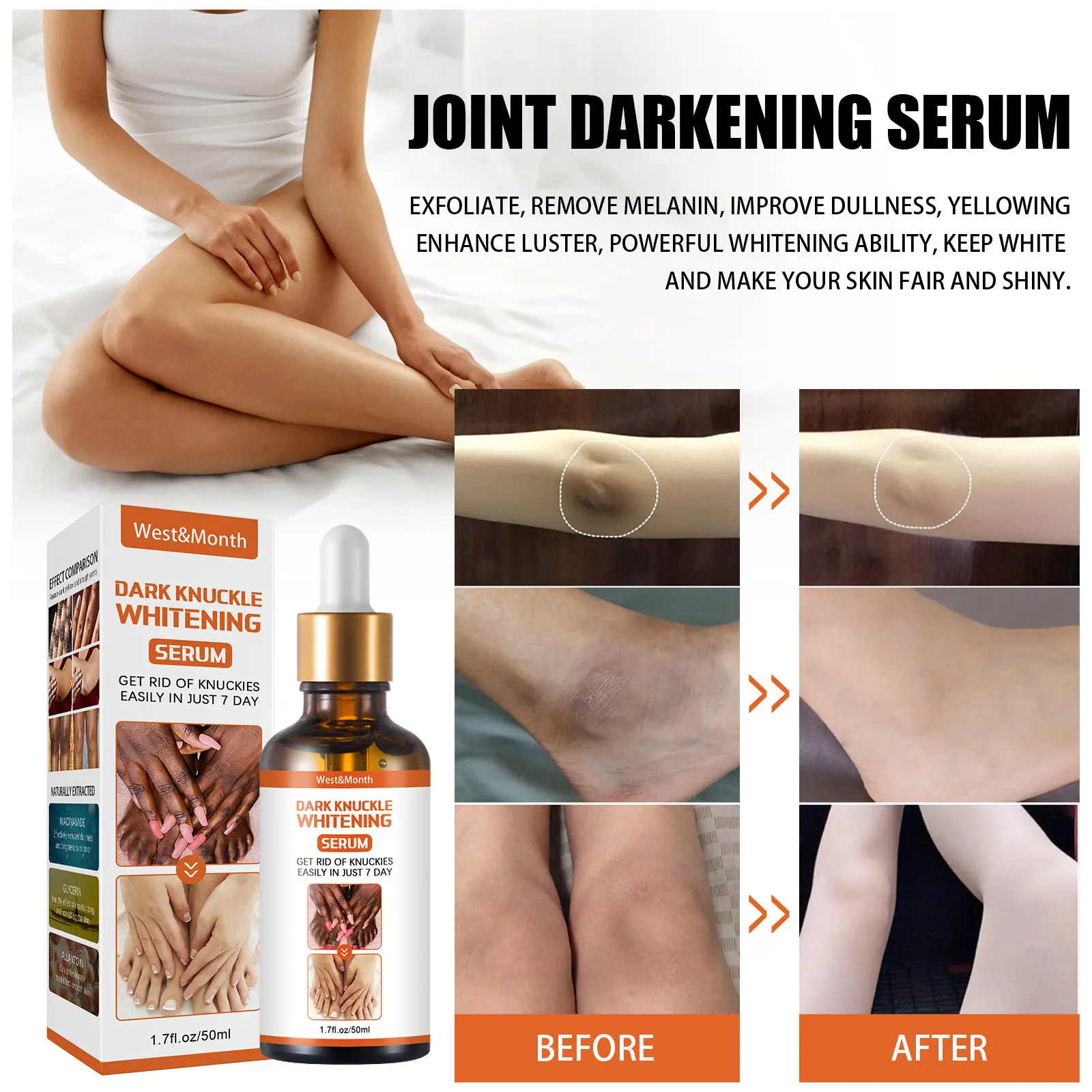 OEM ODM Skin Care Serum for Legs/Arms & Knees/Ankles Whitening Moisturizing Exfoliating with Niacinamide 50ml