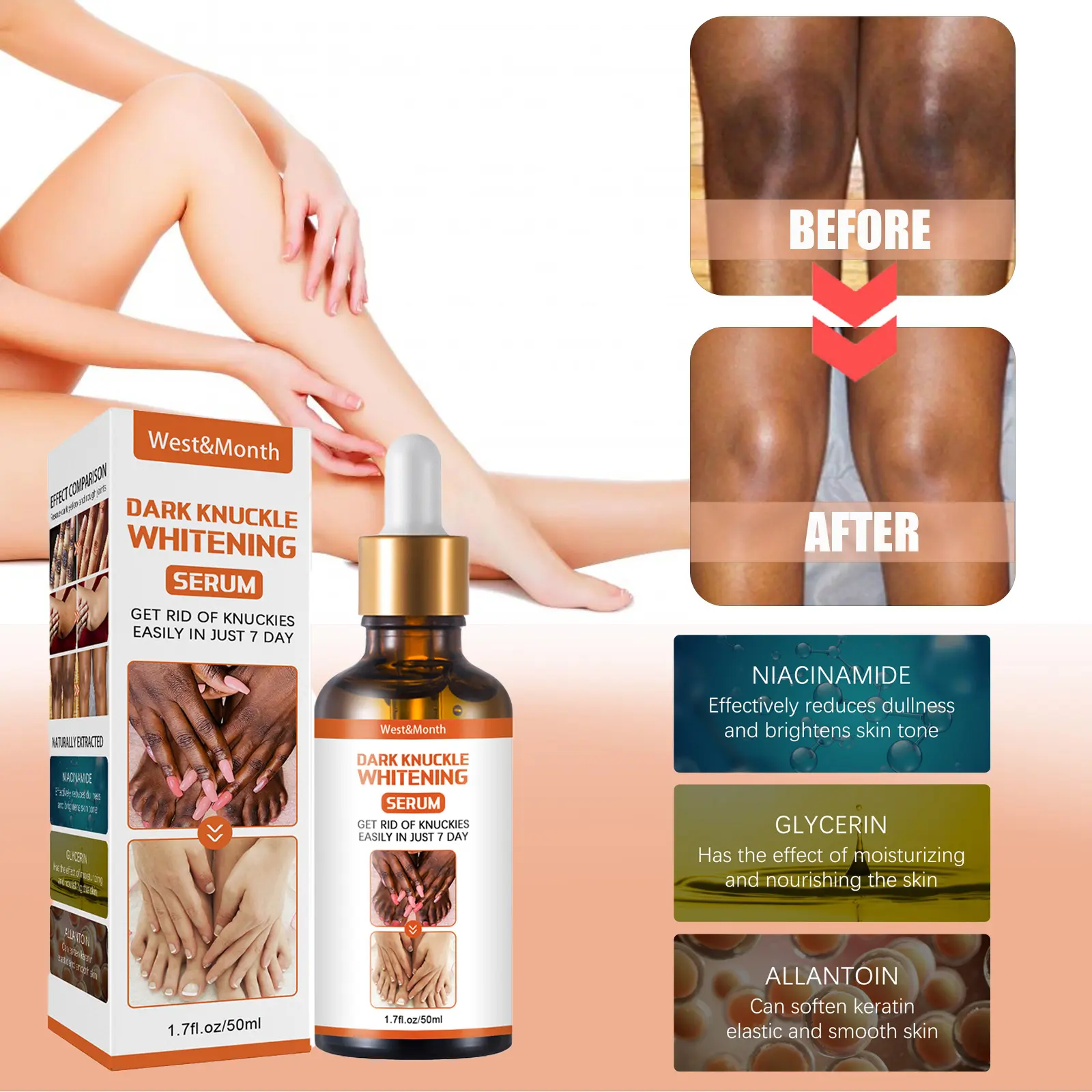 OEM ODM Skin Care Serum for Legs/Arms & Knees/Ankles Whitening Moisturizing Exfoliating with Niacinamide 50ml