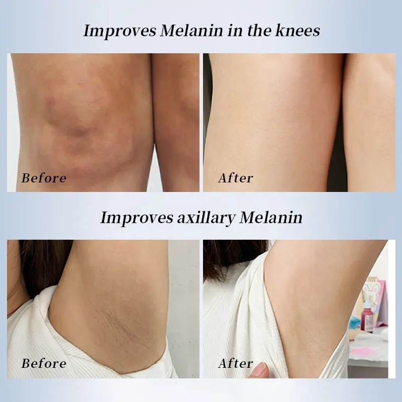 Dark Spot Remover Whitening Cream Collagen Sunscreen Sensitive Skin Arbutin Niacinamide Vegan Cruelty-Free Instant Effect Body