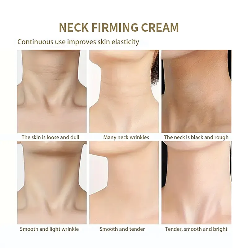 Oem Odm Kojic Acid Neck Skincare Whitening Anti-Aging Moisturizing Deep Hydration Tighten Firm Cream