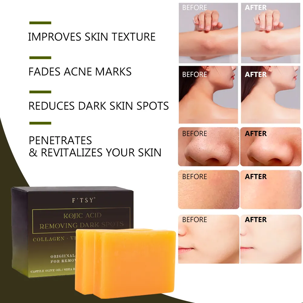 Kojic Acid Dark Spot Remover Soap Bars Skin Whitening Kojic Acid Tumeric Soap Bar Solid Tumeric and Kojic Acid Soap