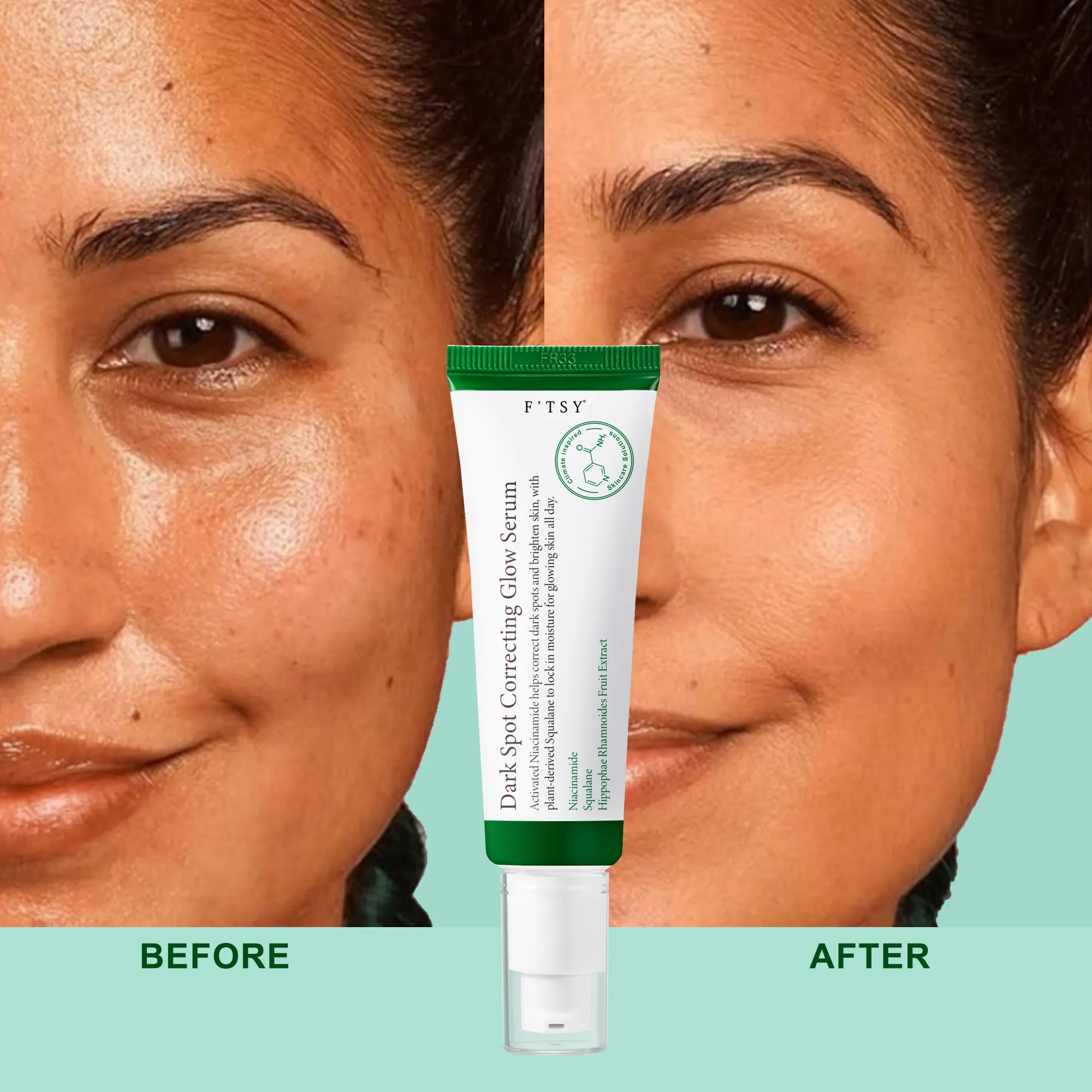 Wholesale Custom Natural Korean Brightening Improve Uneven Skin Tone Hydrating Dark Spot Correcting Glow Serum