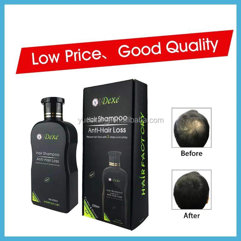 For Restore 2-in-1 Cream Herbal Anti-Hair Loss Shampoo for Adults
