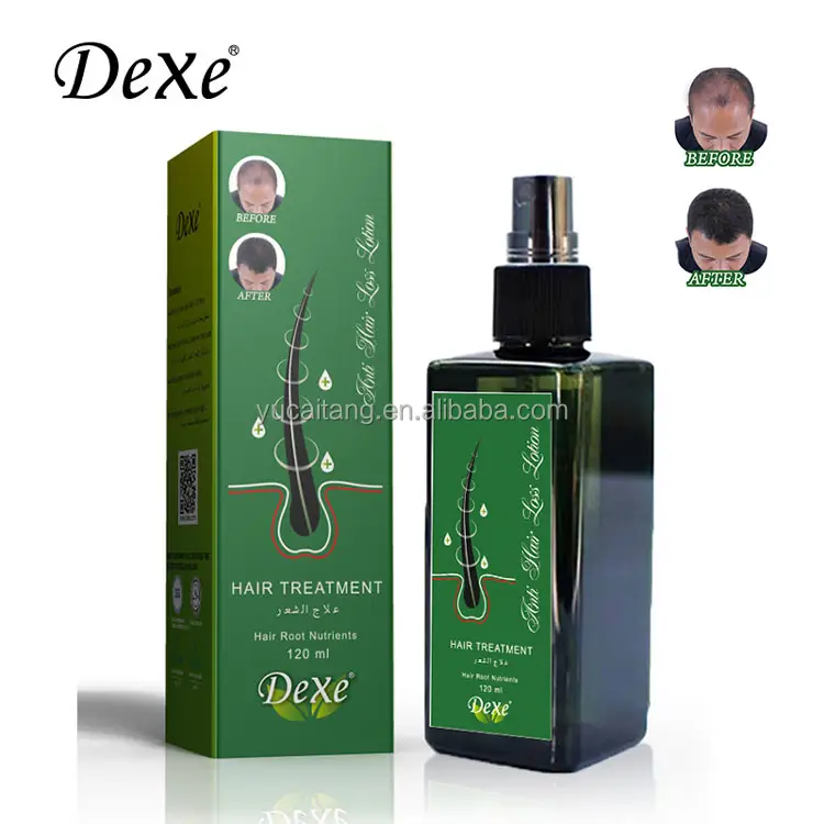 For Herbal Instant Hair Grow Spray 120ml Anti Hair Loss Lotion for Men and Women Use Concentration Formula Wholesale