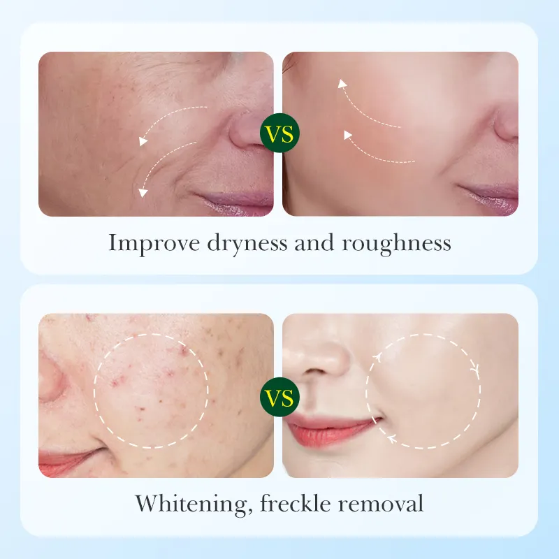 OEM SADOER Korean Skincare Licorice Root Amino Acids Brightening Set Wholesale Natural Vitamin C Whiten Nourish Adult Face Care