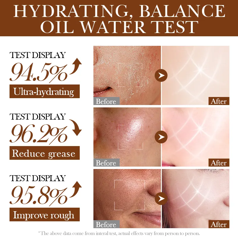 OEM Private Label SADOER Coconut Oil Moisturizing Nourishing Skincare Kit Natural Korean Cosmetics 6PCS Skin Care Set for Women